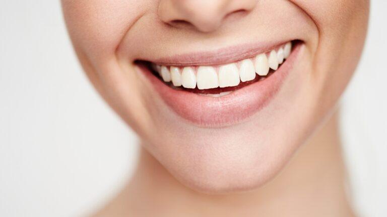 sorriso